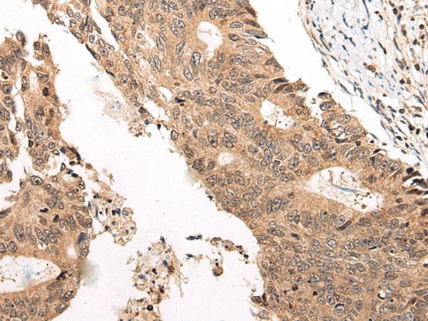 CHAMP1 Polyclonal Antibody (E-AB-19634)