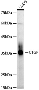 CTGF Polyclonal Antibody (E-AB-93058)