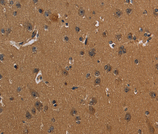 CD242 Polyclonal Antibody (E-AB-11318)