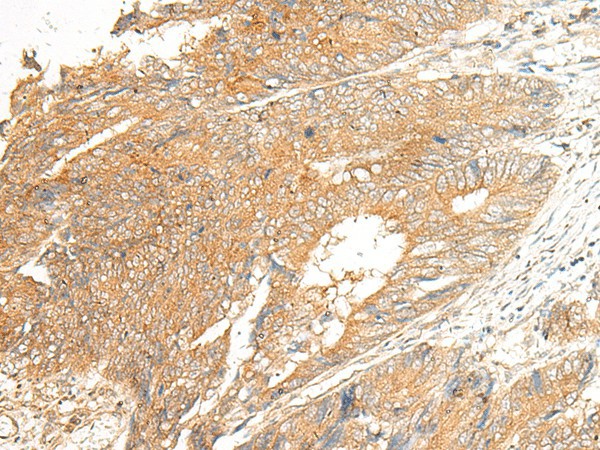 C5AR2 Polyclonal Antibody (E-AB-18014)