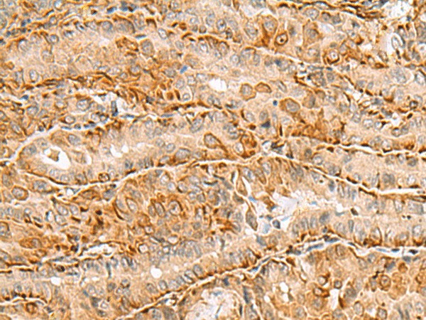C3orf38 Polyclonal Antibody (E-AB-18571)