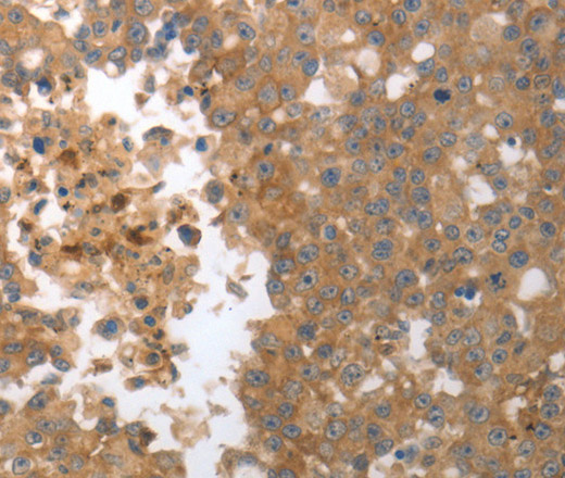 MMP27 Polyclonal Antibody (E-AB-15783)