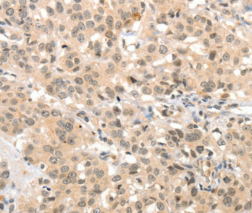 TSPYL2 Polyclonal Antibody (E-AB-13151)