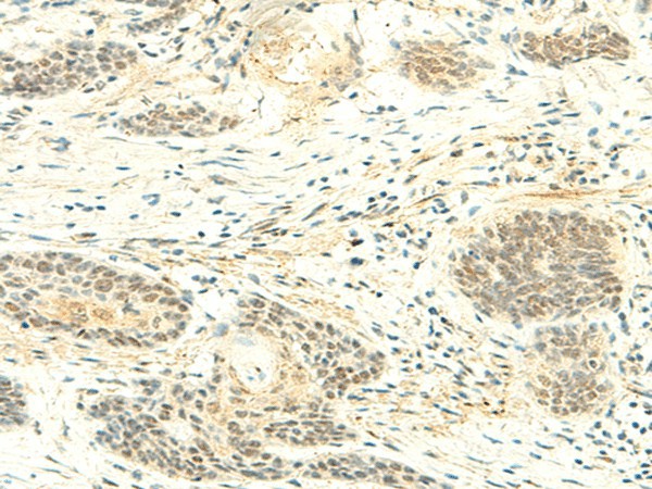 ATMIN Polyclonal Antibody (E-AB-18856)