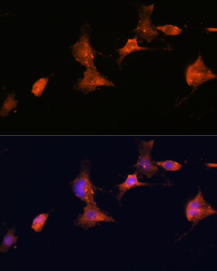 TSC2 Polyclonal Antibody (E-AB-66646)