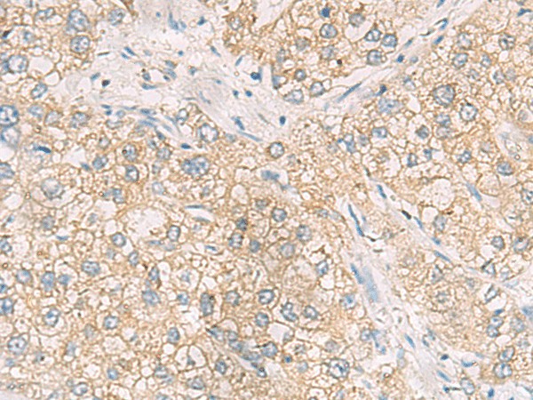 MAPK14 Polyclonal Antibody (E-AB-52163)