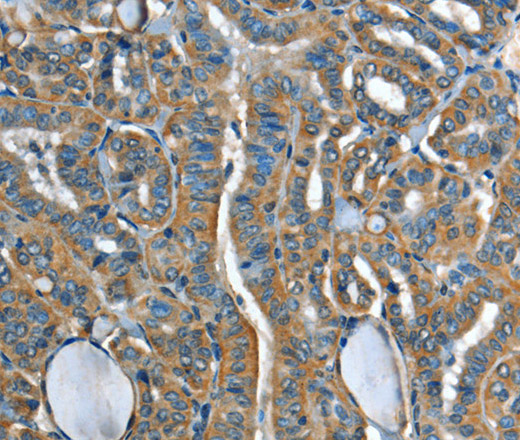ADCY4 Polyclonal Antibody (E-AB-10740)