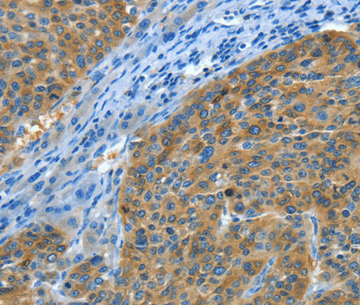 Amphiphysin II Polyclonal Antibody (E-AB-13951)
