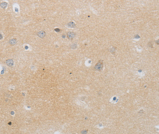 MMP25 Polyclonal Antibody (E-AB-12571)