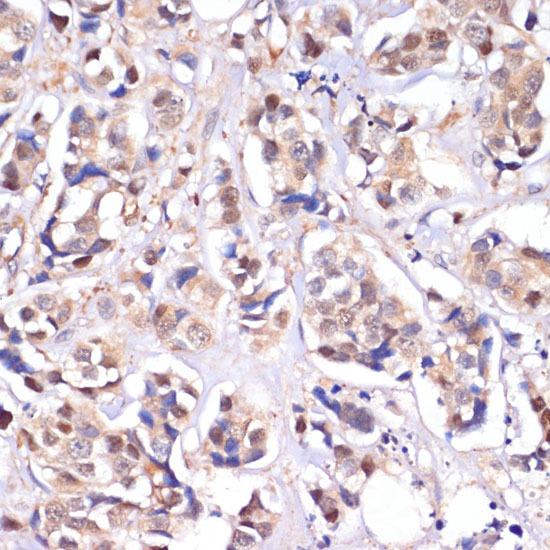 MST1/MST1/MST1/MST1/STK4 Polyclonal Antibody (E-AB-93353)