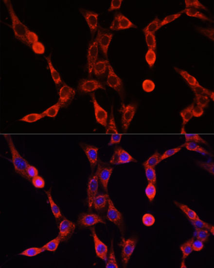ABCD1 Polyclonal Antibody (E-AB-65875)