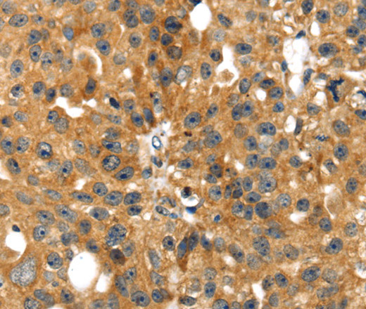 SMYD4 Polyclonal Antibody (E-AB-11590)