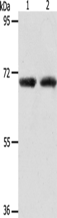 ACOT11 Polyclonal Antibody (E-AB-14478)