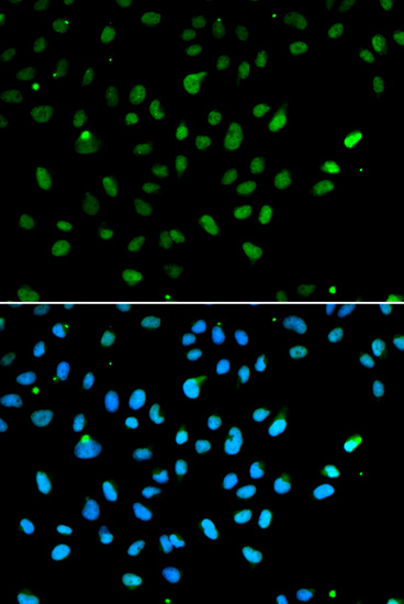 (KO Validated) SMARCA4 Polyclonal Antibody (E-AB-60619)
