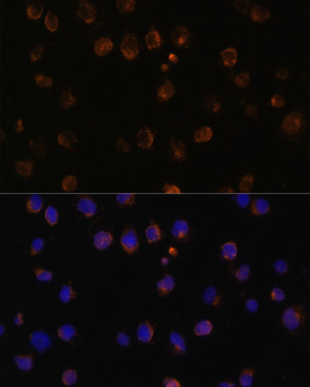 MyD88 Polyclonal Antibody (E-AB-65719)