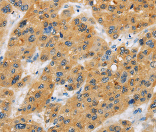 CD272 Polyclonal Antibody (E-AB-14847)