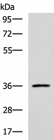IBSP Polyclonal Antibody (E-AB-19332)