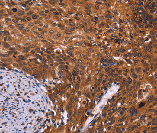 CDC5L Polyclonal Antibody (E-AB-10935)
