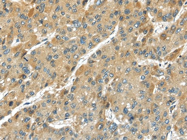 TMPRSS11D Polyclonal Antibody (E-AB-17120)