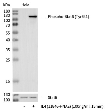 Recombinant Phospho-Stat6 (Tyr641) Monoclonal Antibody (AN300083L)