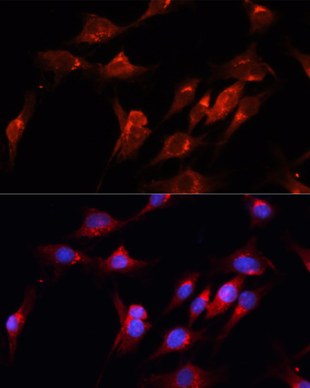 CUX1 Polyclonal Antibody (E-AB-62060)