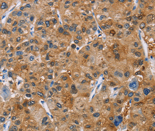 NCR3 Polyclonal Antibody (E-AB-11059)