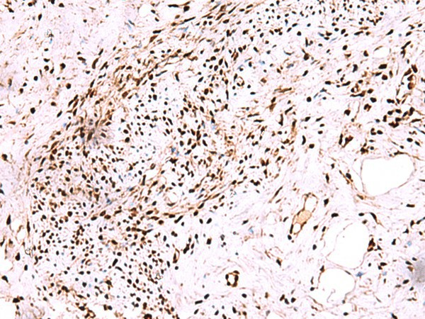 CDKN1B Polyclonal Antibody (E-AB-52142)