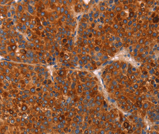 GC Polyclonal Antibody (E-AB-14443)