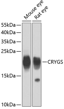 CRYGS Polyclonal Antibody (E-AB-62697)