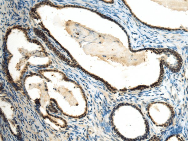 SUV39H2 Polyclonal Antibody (E-AB-53163)