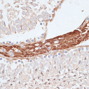 KIFC1 Polyclonal Antibody (E-AB-67573)