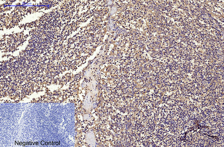 CD68 Monoclonal Antibody (E-AB-22013)