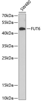 FUT6 Polyclonal Antibody (E-AB-62749)