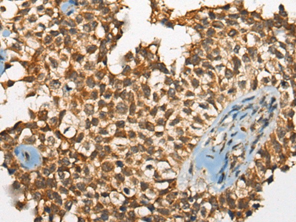 ODF2 Polyclonal Antibody (E-AB-19692)