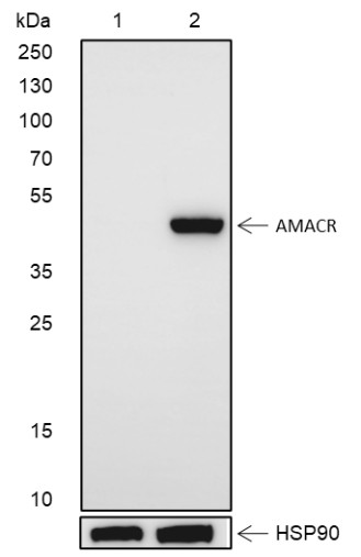 Recombinant AMACR Monoclonal Antibody (AN301415L)