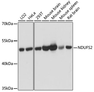 (KO Validated) NDUFS2 Polyclonal Antibody (E-AB-64354)