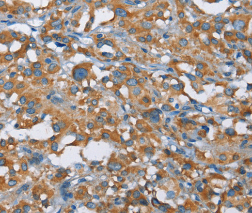 KLF7 Polyclonal Antibody (E-AB-14175)