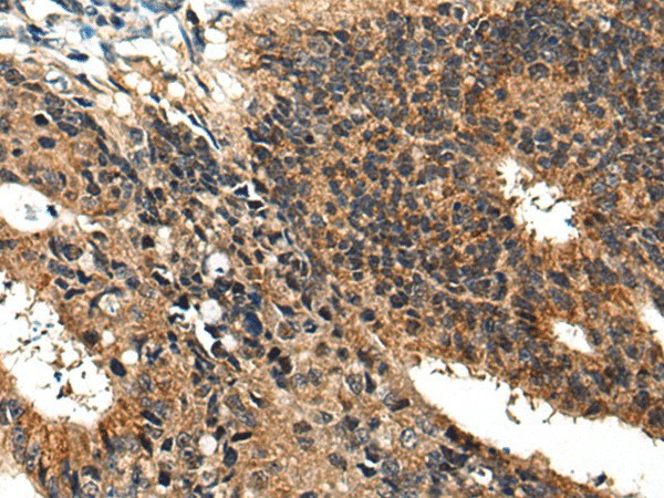 BMPER Polyclonal Antibody (E-AB-19619)