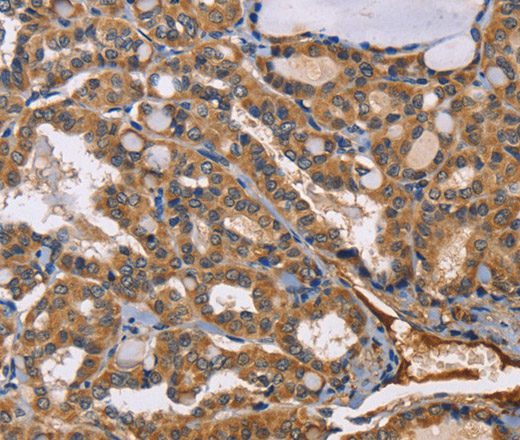 EPHB6 Polyclonal Antibody (E-AB-10907)