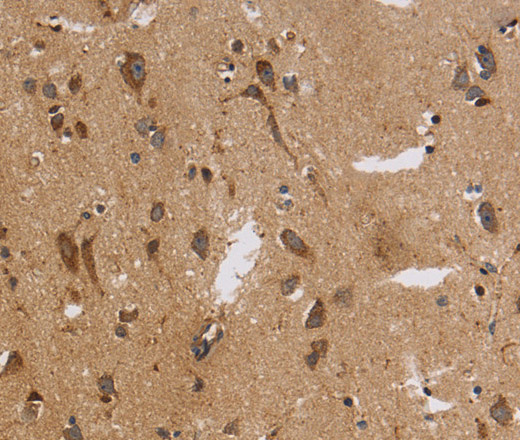 ITPR3 Polyclonal Antibody (E-AB-16530)