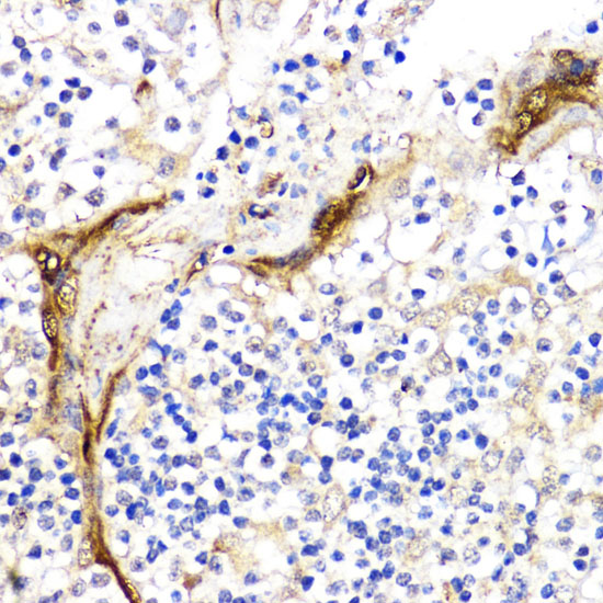 BMPR1B Polyclonal Antibody (E-AB-60551)