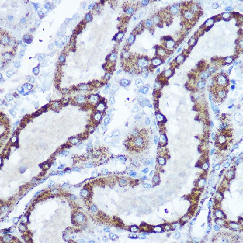 SOD2 Polyclonal Antibody (E-AB-93344)