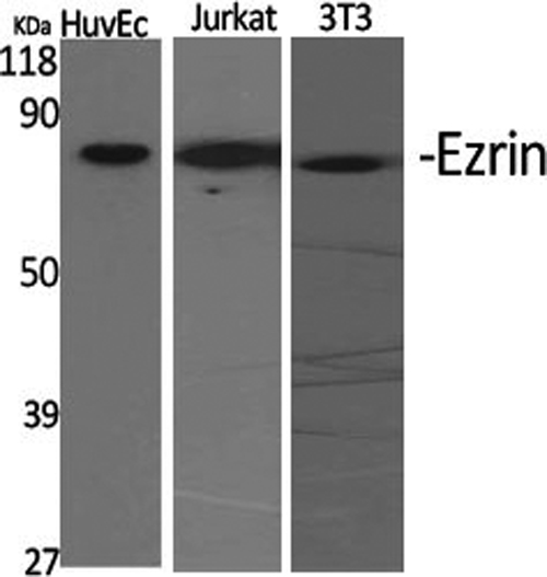 EZR Polyclonal Antibody (E-AB-31393)