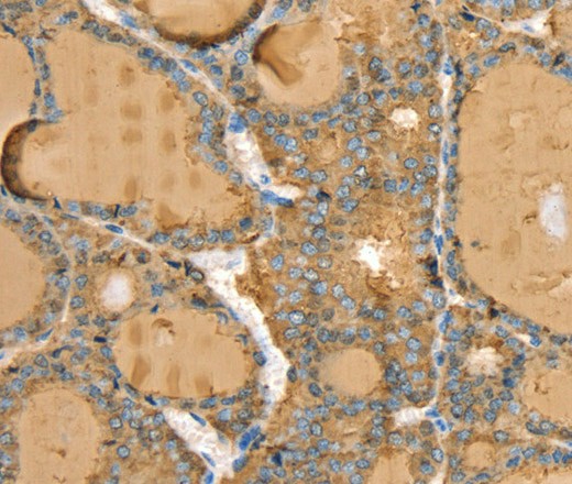 TG Polyclonal Antibody (E-AB-16913)