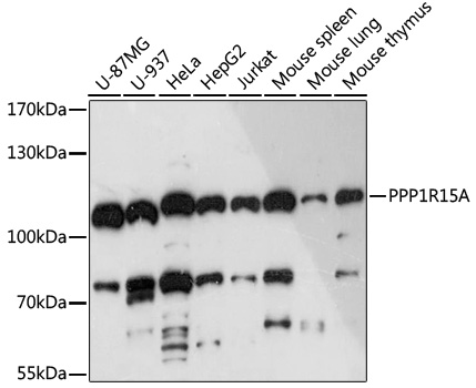 PPP1R15A Polyclonal Antibody (E-AB-91486)