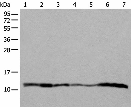 UQCRQ Polyclonal Antibody (E-AB-52443)