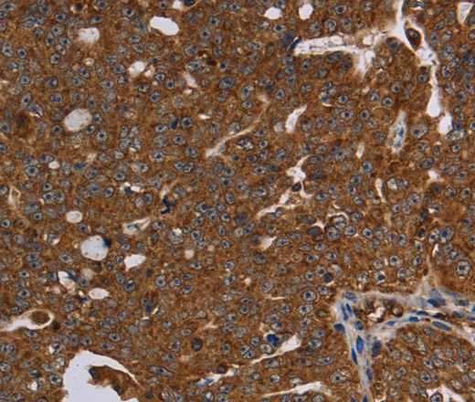 HSD17B13 Polyclonal Antibody (E-AB-11308)