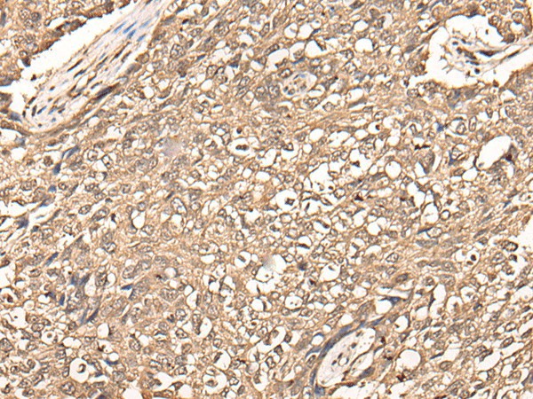 USP21 Polyclonal Antibody (E-AB-52446)