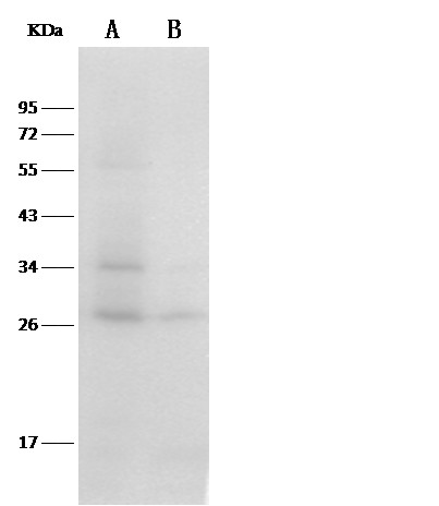 Recombinant Thioredoxin/TXN/SASP Monoclonal Antibody (AN300563P)
