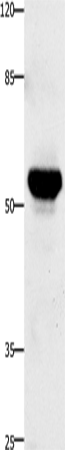 TNFRSF21 Polyclonal Antibody (E-AB-12371)